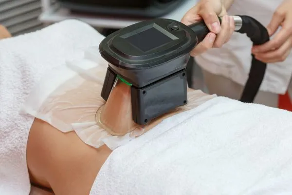 Image of person having fat freezing treatment to help weight gain Bournemouth