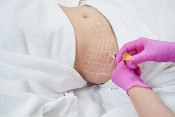 image of fat dissolving injections on love handles to help combat weight gain Bournemouth