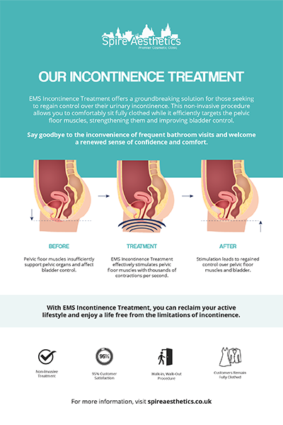 image of how urge incontinence Bournemouth treatment works