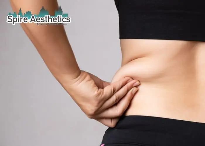 Image of woman pinching fat on their hips Bournemouth. Fat Freezing treatment