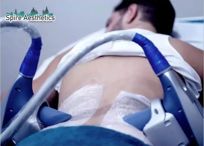 Man having fat freezing treatment done on love handles before a competitions Bournemouth to create a sculpted look.