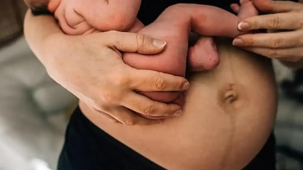 Why Is My Stomach Still Big After Pregnancy Bournemouth?